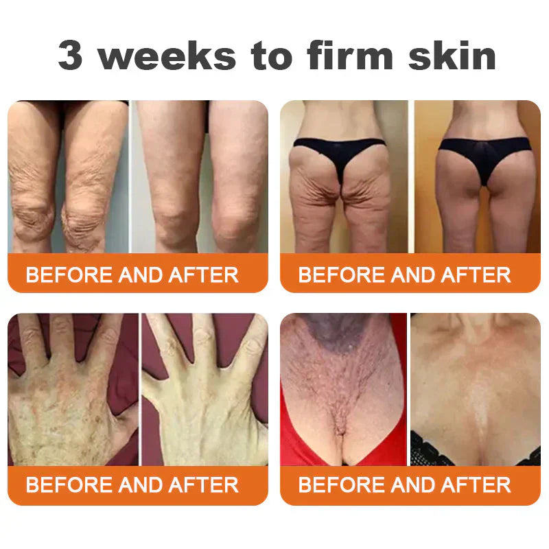 âĄđĽLimited Time Only: Get 50% Off Now! đ Odeiun⢠Botox Bee Venom Firming Serum Stick