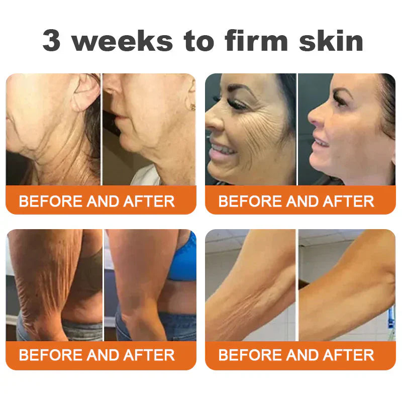 âĄđĽLimited Time Only: Get 50% Off Now! đ Odeiun⢠Botox Bee Venom Firming Serum Stick