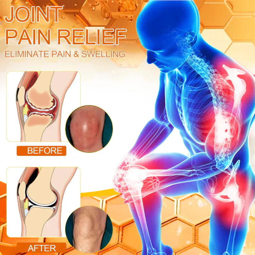 š ODEIUN⢠Magnesium & Bee Venom Joint Spray | Relieve Stiffness & Pain in 4 Weeks ā No Rebound, Just Results šŖ