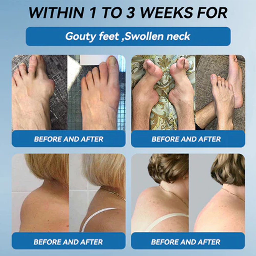 LBMLBM™ BPC-157 Joint Healing Cream  FDA Certified (Targets arthritis, nerve pain, rheumatism & sports-related stiffness for better mobility)