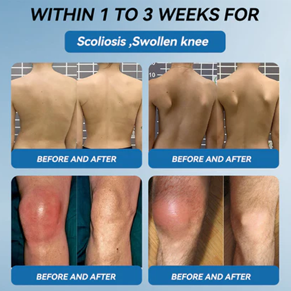 LBMLBM™ BPC-157 Joint Healing Cream  FDA Certified (Targets arthritis, nerve pain, rheumatism & sports-related stiffness for better mobility)