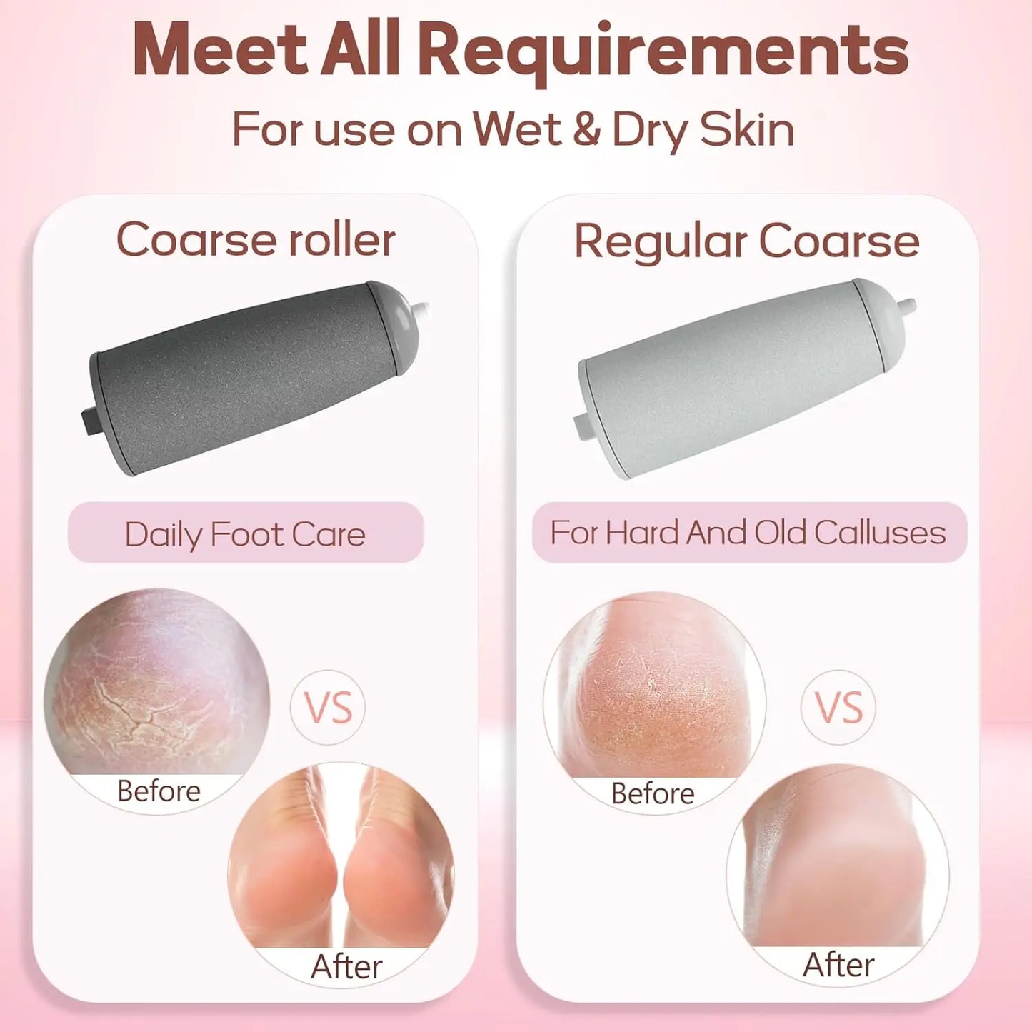 ODEIUN™ Rechargeable Electric Foot Callus Remover