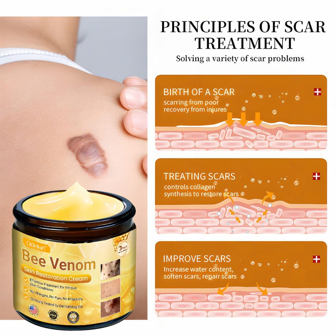 ✨ ODEIUN™ Bee Venom Skin Restoration Cream - Revitalize & Renew Your Skin Naturally! 🌿🐝