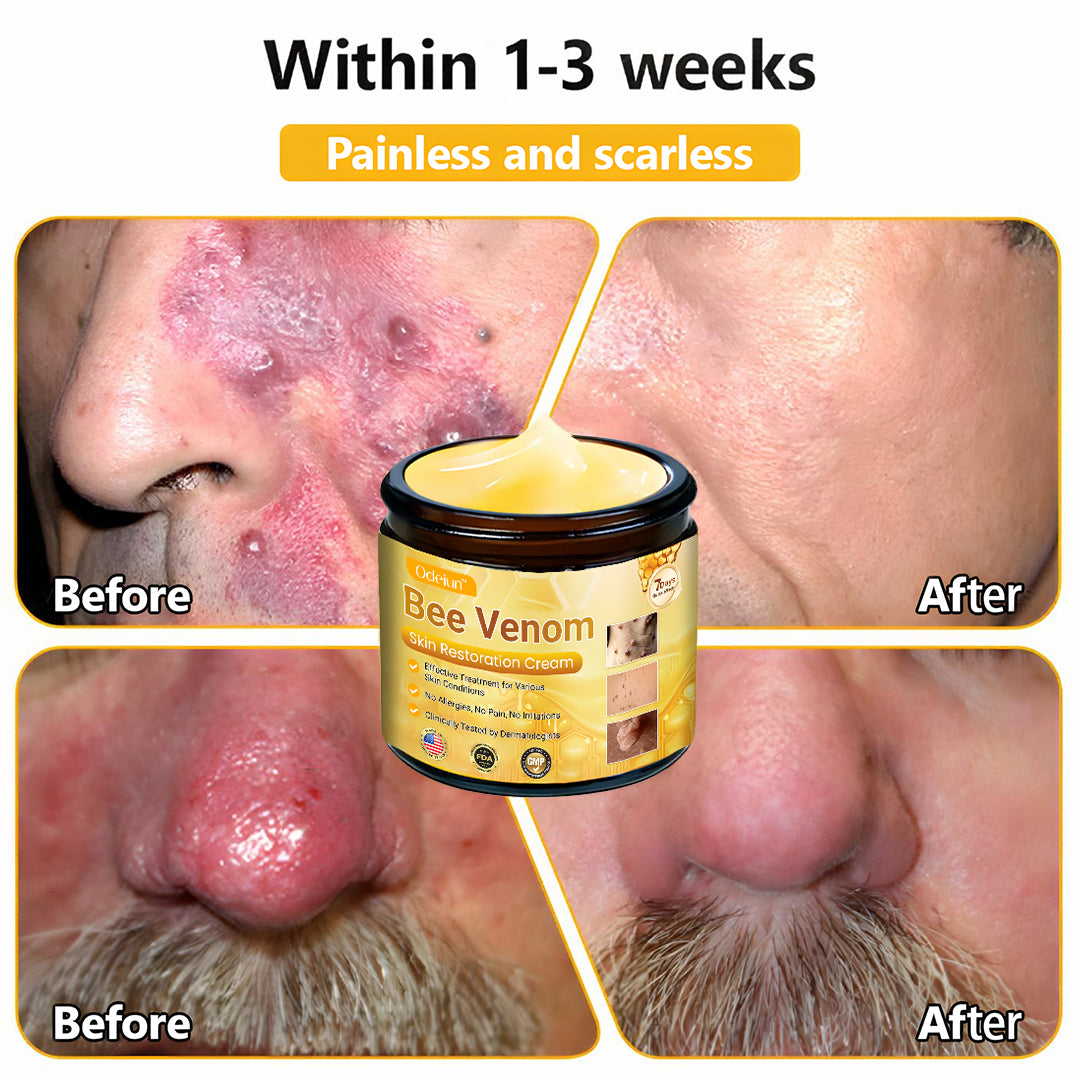 ✨ ODEIUN™ Bee Venom Skin Restoration Cream - Revitalize & Renew Your Skin Naturally! 🌿🐝