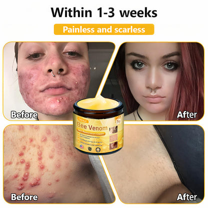 ✨ ODEIUN™ Bee Venom Skin Restoration Cream - Revitalize & Renew Your Skin Naturally! 🌿🐝