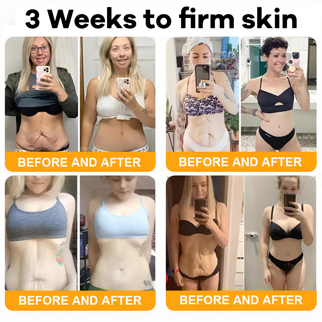 ✨ ODEIUN™ Bee Venom Skin Restoration Cream - Revitalize & Renew Your Skin Naturally! 🌿🐝