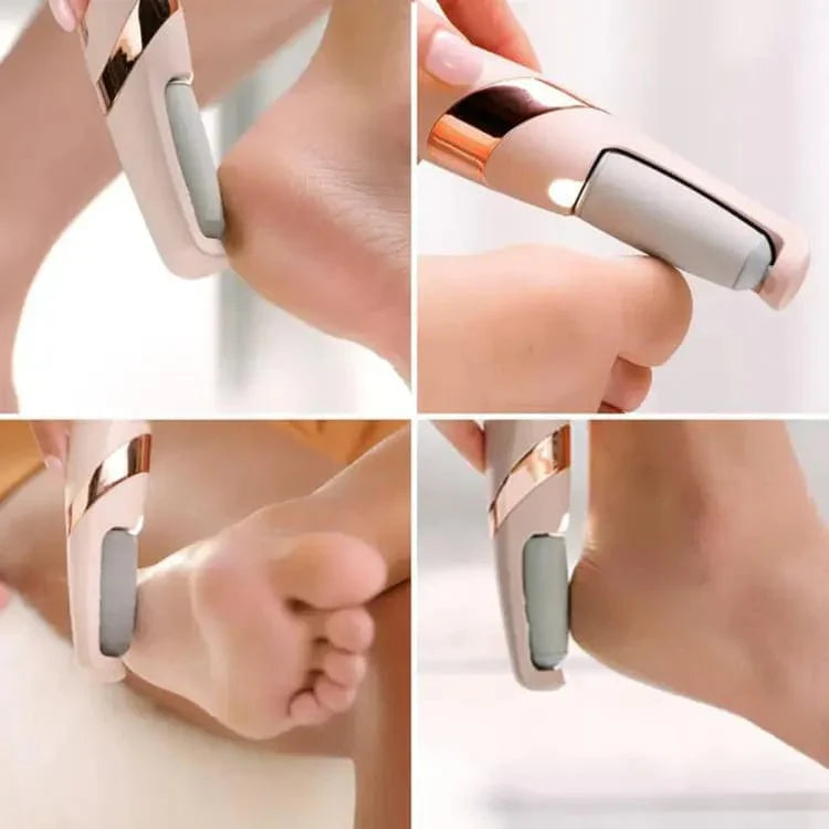 ODEIUN™ Rechargeable Electric Foot Callus Remover