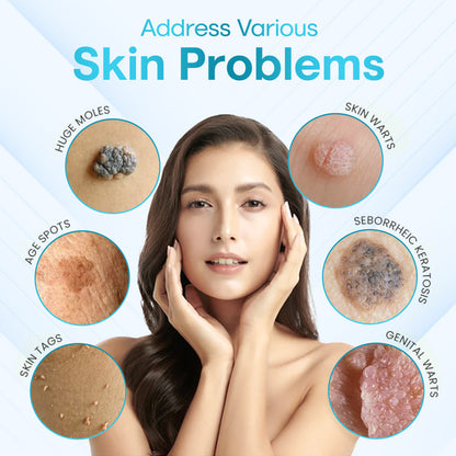 ✅ ODEIUN™ Professional Mole Removal Serum – Trusted Dermatological Formula 🩺