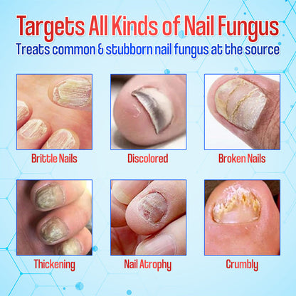 Zakdavi™ Anti-Fungal Nail Repair Patches — Say Goodbye to Nail Fungus in Days! 💅