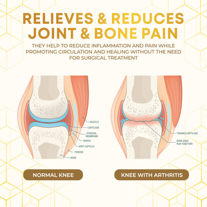 Seurico™ Bee Venom Joint Therapy Pain Relief Gel🐝🔥