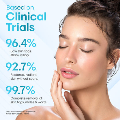 ✅ ODEIUN™ Professional Mole Removal Serum – Trusted Dermatological Formula 🩺