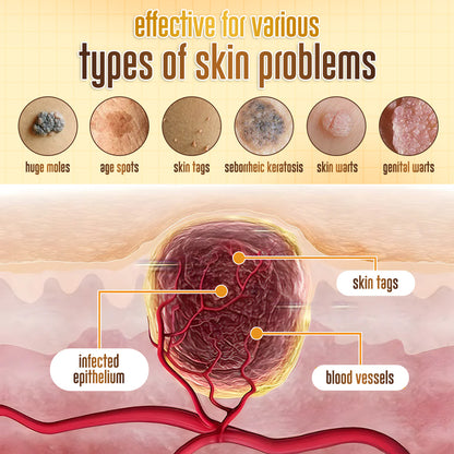 ✨ ODEIUN™ BeeDerm RX Cream – Natural Wart, Mole & Skin Tag Remover with Healing Bee Venom