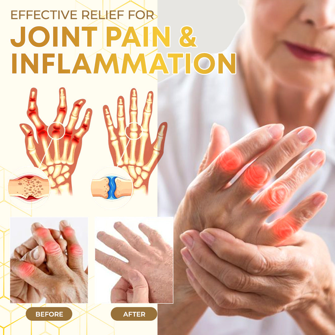 Seurico™ Bee Venom Joint Therapy Pain Relief Gel🐝🔥