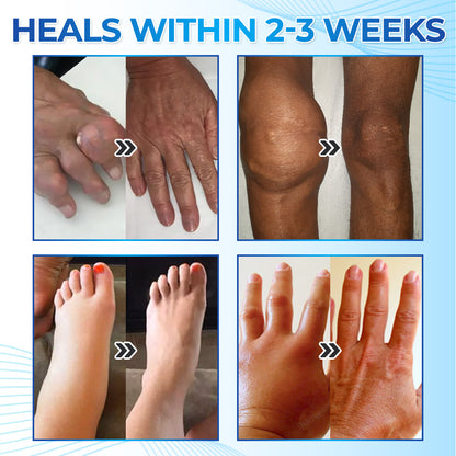 ✅ Mayo Clinic Approved: Seurico™ Magnesium Pain & Bone Healing Cream – Fast Relief for Neuropathy, Arthritis, Muscle Spasms & Injuries