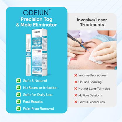 ✅ ODEIUN™ Professional Mole Removal Serum – Trusted Dermatological Formula 🩺