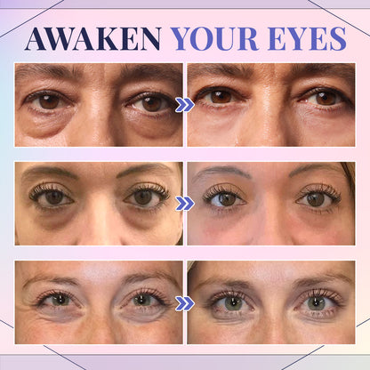 Seurico™ Advanced Eye Cream with Complete Collagen