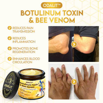 🎁Flash Sale - ODALIT™ Botulinum Toxin & Bee Venom Pain-Relief Bone Healing Cream