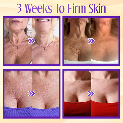 ✨ ODEIUN™ Queen Nectar Peptide + Bakuchiol Cream – Anti-Aging, Firming & Hydrating 🌸