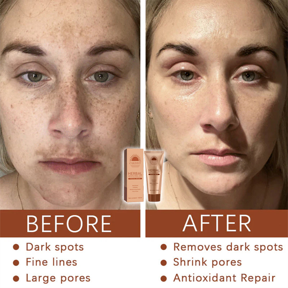 Zakdavi™ Herbal Spots Peel-Off Facial Mask
