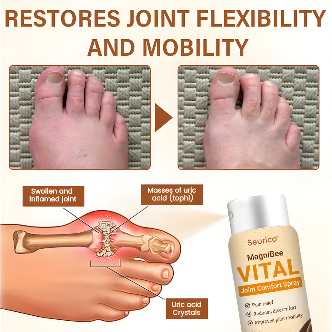 Seurico™ Joint Comfort Spray – FDA-Approved Fast Relief & Mobility Support