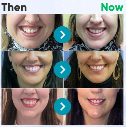 ODEIUN™ VioCore Bee Venom Dental Treatment Toothpaste