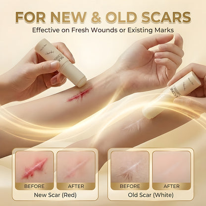 ODEIUN™ Silicone Scar Stick: Smooth, Fade & Firm