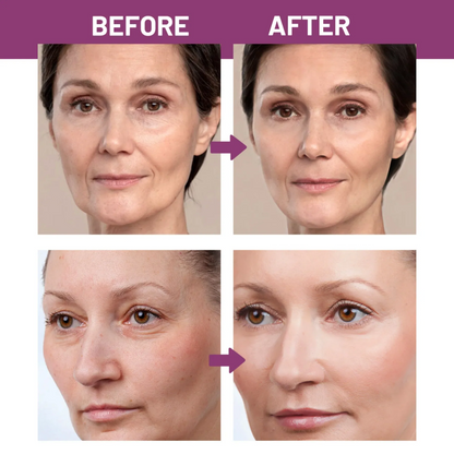 Calcium Multi Balm | Firm, Smooth & Hydrate in 7 Days