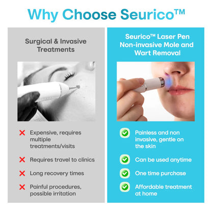 ✨Seurico™ Laser Pen - Non-invasive Mole and Wart Removal