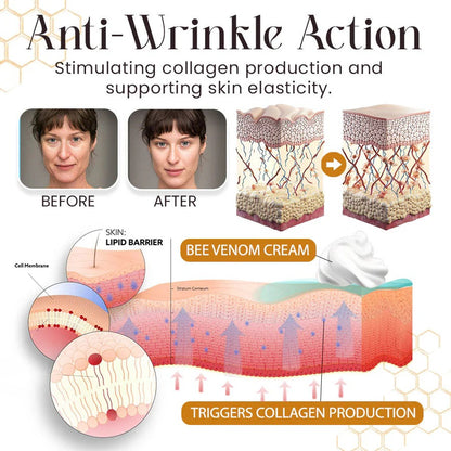 LBMLBM™ Botox Bee Venom Wrinkle Removal Cream – Look Younger in Days | 50% OFF Today Only ✅