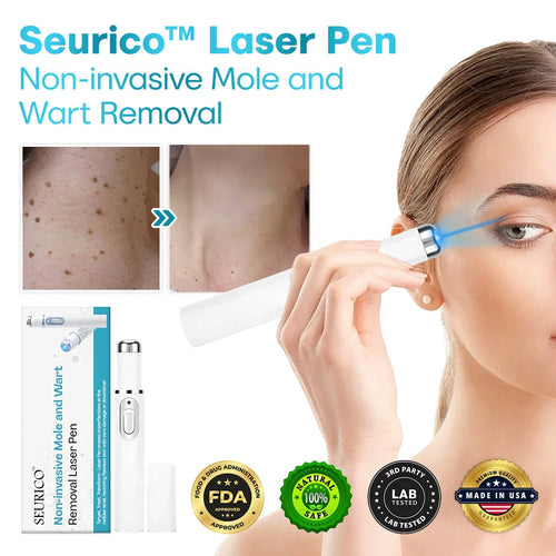 ✨Seurico™ Laser Pen - Non-invasive Mole and Wart Removal