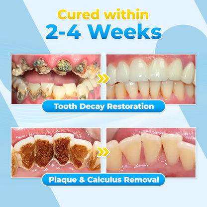 Odeiun™ Bee Venom Gum Repair Powder 🐝 (ADA Approved) 🎁 Flash Sale – Restore Teeth & Gums Now!