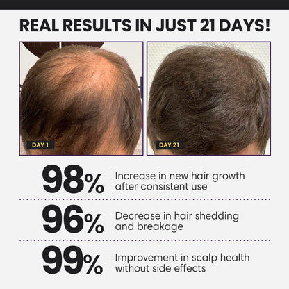 Odeiun™ Follicle Boost 5X Hair Growth Serum