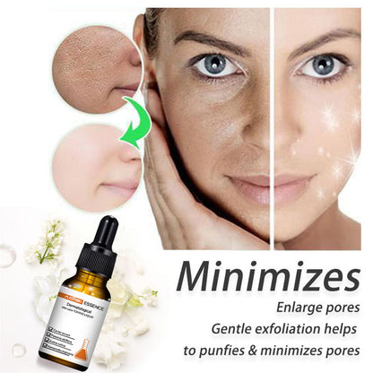 🔥2022 New Instant Perfection Wrinkles Essence-BUY 3 FREE SHIPPING